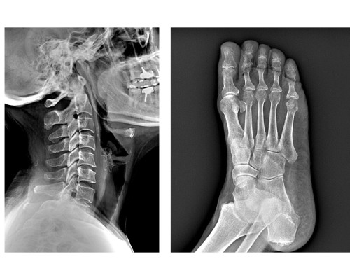 Digital Flat Panel X-ray Detector_Low-Dose, High-Quality Imaging_SGSC