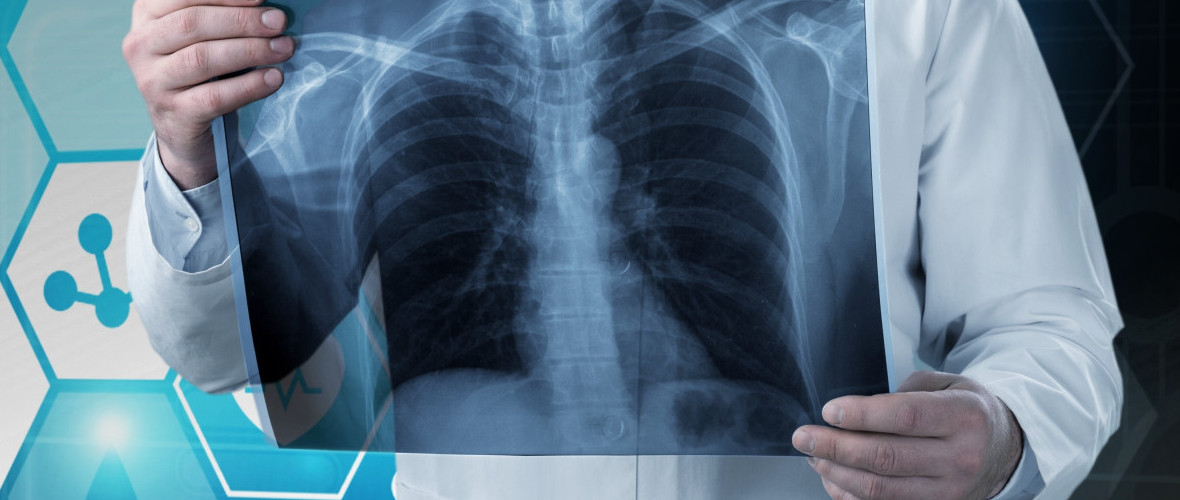 Chest X-ray AI Screening Solution_Detection of 10 Chest Abnormalities, Including Tuberculosis and Pneumonia_SGSC