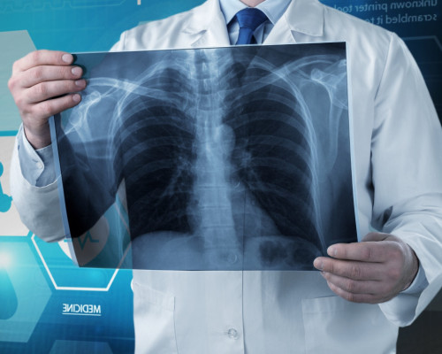 Chest X-ray AI Screening Solution_Detection of 10 Chest Abnormalities, Including Tuberculosis and Pneumonia_SGSC