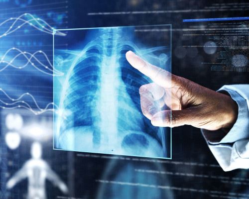 Chest X-ray AI Screening Solution_Seamless Integration with Multi-Brand X-ray and PACS Systems_SGSC