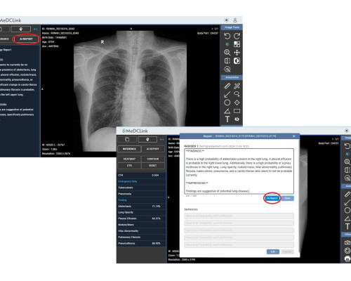 AI-Powered Cloud-Based PACS_Generative Reporting to Reduce Healthcare Workloads_SGSC AI-Powered Cloud-Based PACS_Generative Reporting to Reduce Healthcare Workloads_SGSC