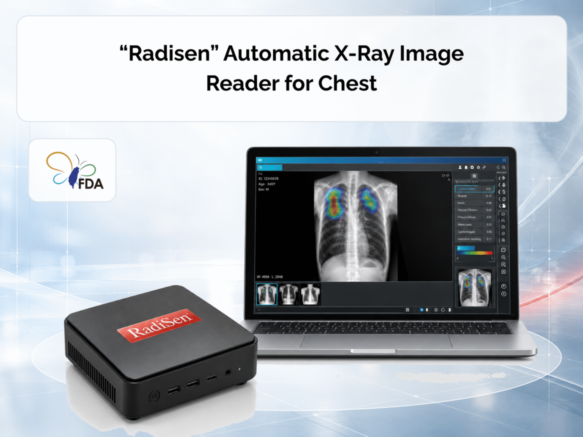 SGSC Secures Taiwan Medical Device Licence for RadiSen AXIR-CX to Advance AI-Assisted Chest X-ray Imaging. 智群智慧 SGSC 代理 RadiSen 胸腔 X 光 AI 取得台灣醫療器材許可證